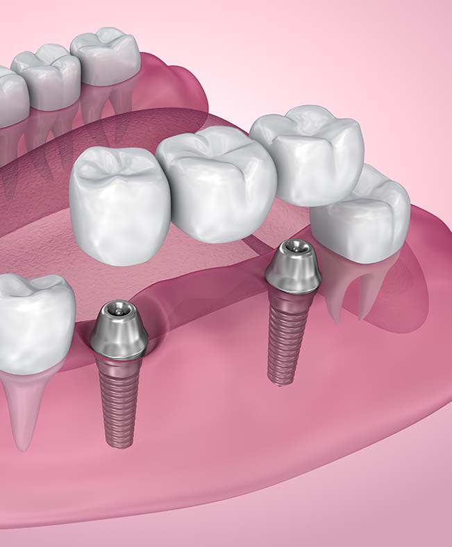 Treatment - Ashtree House Dental